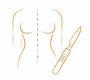 수술적 치료 이미지
